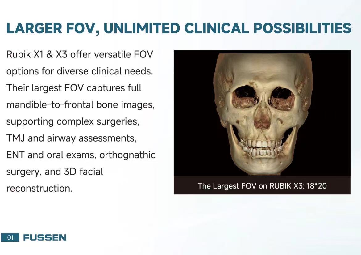 Fussen CBCT -- Rubik X1