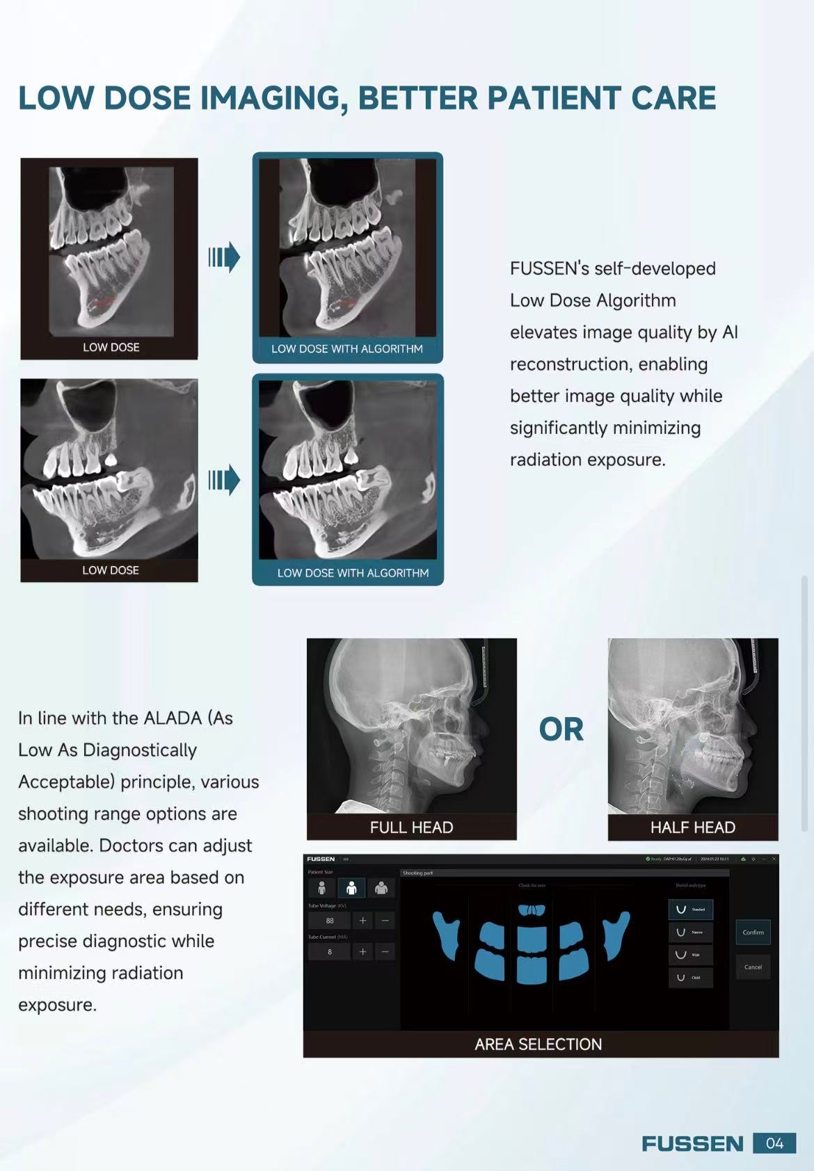 Fussen CBCT -- Rubik X1