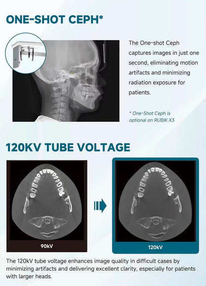 Fussen CBCT -- Rubik X1