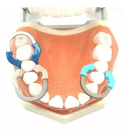 Dental Sectional Matrix Bands Ring Clamp