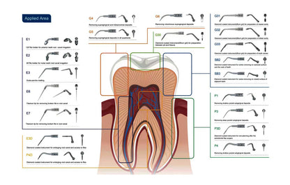 Dental Ultrasonic Scaler Tips Compatible with EMS & Satelec  SB1,SB2,SB3,SBL，GD1,GD2,GD3,GD4,GD5,GD6，PD1,PD3,PD4