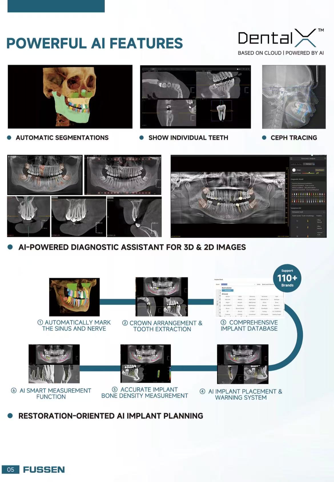 Fussen CBCT -- Rubik X1